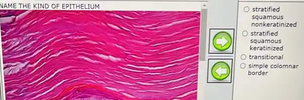 NAME THE KIND OF EPITHELIUM
stratified
squamous
nonkeratinized
stratified
squamous
keratinized
transitional
simple colomnar
border